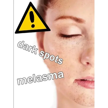 Dark Spot Remover for Face Removing Freckle target hyperpigmentation  age spots sun spot Whitening MOISTURIZING skin beauty care