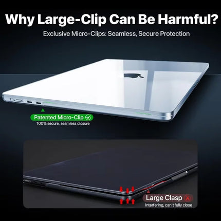 100% Ultra-Clear, Shatterproof Shell for 13' MacBook Pro (M2/M1 2025, 2022-2017 A2159, A1706) – Sturdy, Cushioned, Resists Scrat