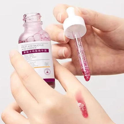 Salicylic Acid Care Essence Deep Hydration Gentle Nourishment Soothes Redness Smooths & Refines Firm Protection 2026