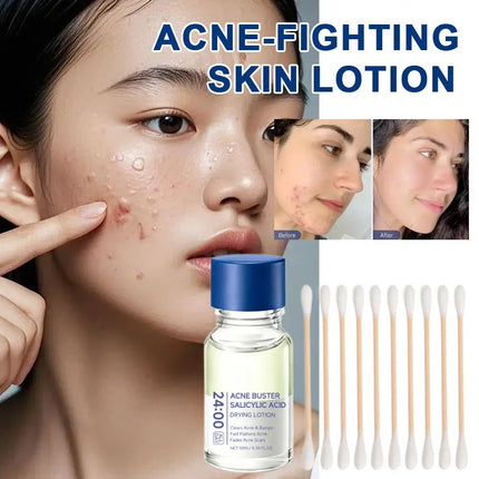 Salicylic Acid Essence Treatment Lotion Drying Lotion Face Serum with Cotton Swab Fade Acne Scars Minimize Pores for Skin-Smooth
