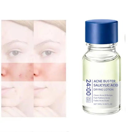 Salicylic Acid Essence Treatment Lotion Drying Lotion Face Serum with Cotton Swab Fade Acne Scars Minimize Pores for Skin-Smooth