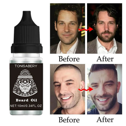 High Quality Fast Beard Growth Serum For Men Promote Beard Regrowth Thicker Longer Fuller Anti Hair Loss Essential Oil Hair Care